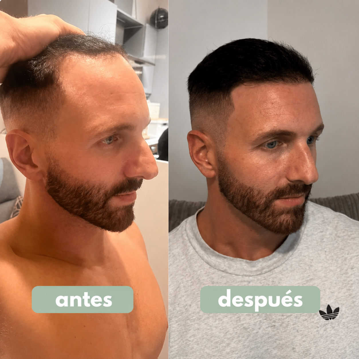 SERUM REVERSE
